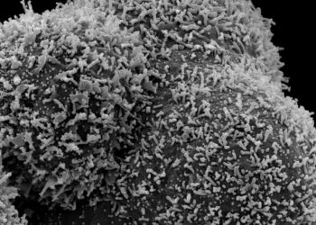 As long Covid studies continue, researchers cast a wider net