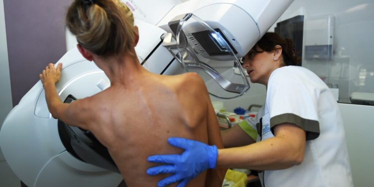 New research sheds light on how often breast cancer is overdiagnosed