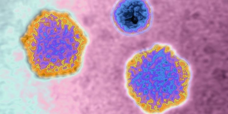Alabama Cases Linked To Common Virus May Provide Clue
