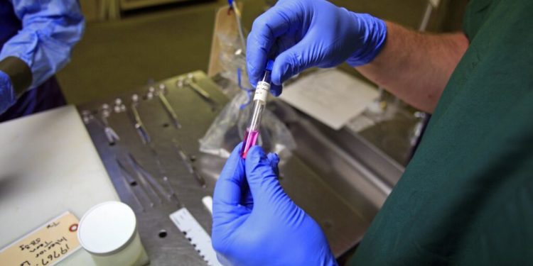 Colorado man’s positive test for bird flu puts 10 people under watch- STAT