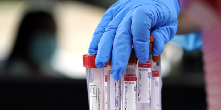 With Omicron, nearly 60% in U.S. have been infected during pandemic