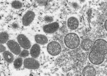Coloradan believed to have monkeypox, but public risk is low