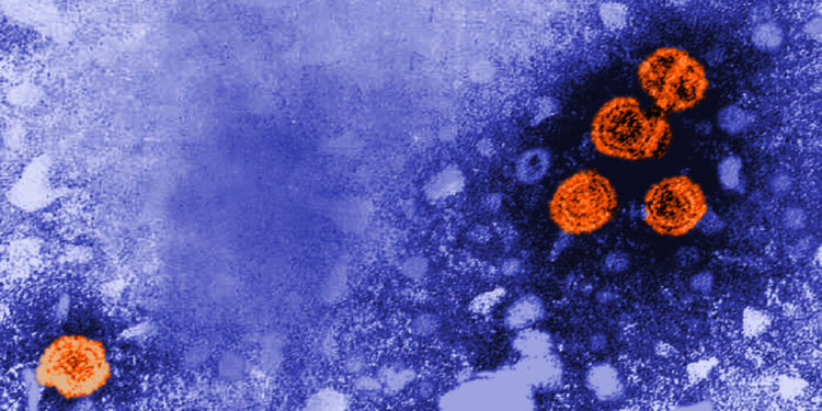 Disease detectives see clues in viral hepatitis cases in kids