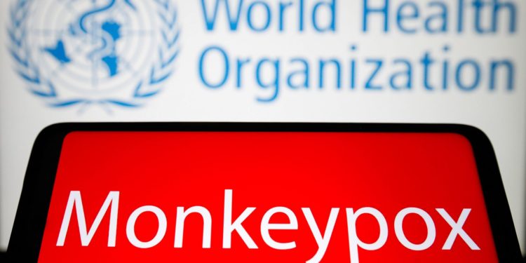 Florida Reports First Case Of Monkeypox, Third Case In The U.S.