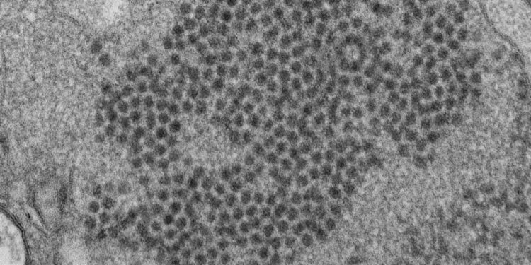 Puzzling pediatric hepatitis cases echo an earlier mysterious illness