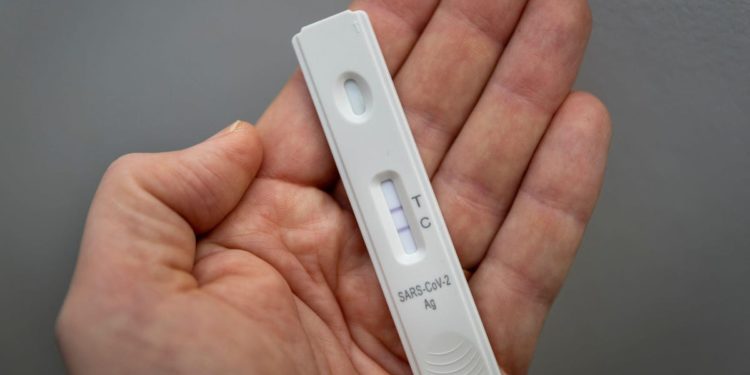 Severe Covid Can Drop Your IQ 10 Points, Study Suggests