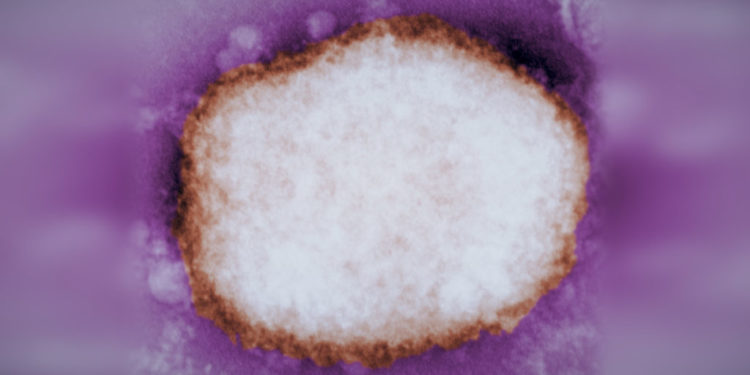 Spain, Portugal report monkeypox cases, raising specter of wider outbreak