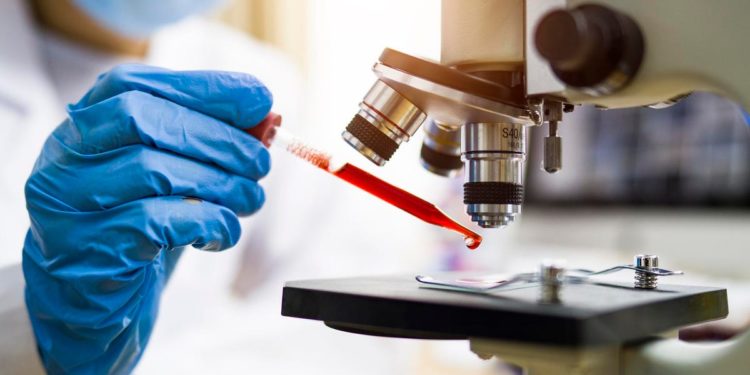 People With HIV Face Higher Risk Of Breakthrough Covid, Study Says