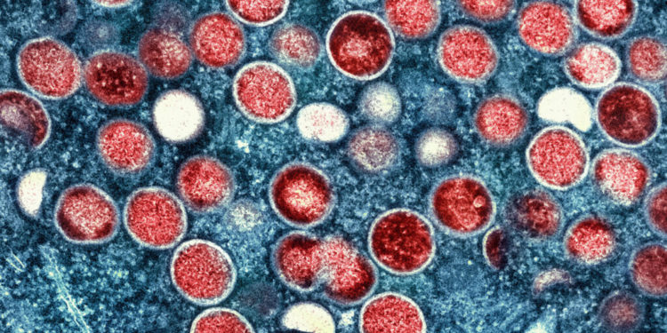 Scientists push to drop 'stigmatizing' names of monkeypox viruses