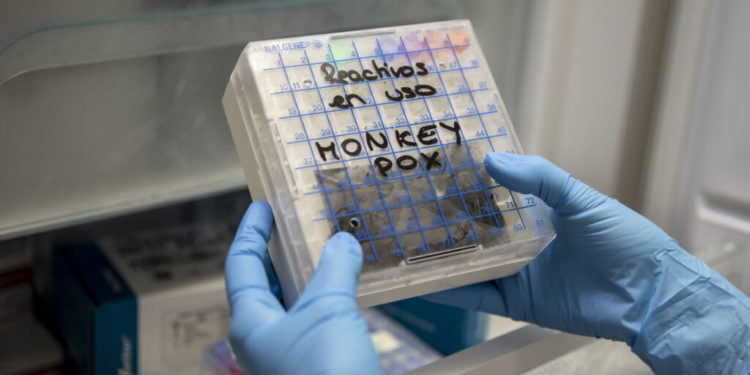 'Testing bottleneck' for monkeypox puts control at risk, experts warn
