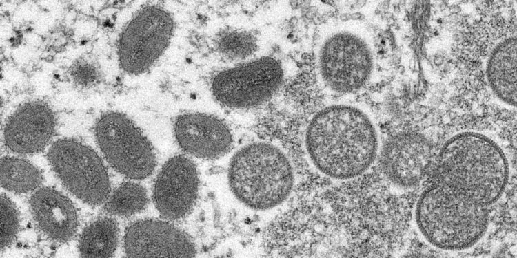 There May Be 2 Distinct Strains Of Monkeypox Circulating In The U.S.