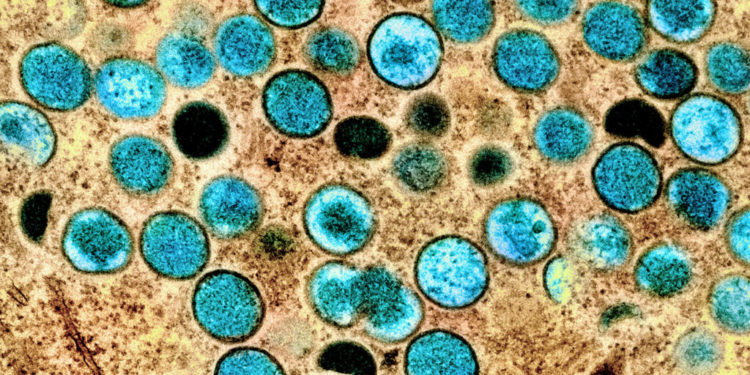 What to make of the many mutations on the monkeypox genome