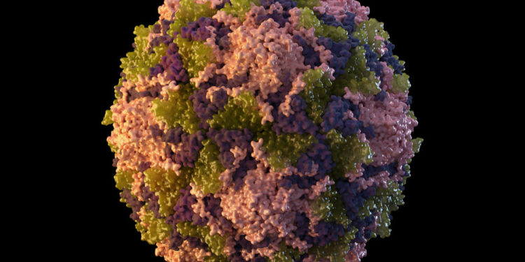 U.S. polio case tied to viruses seen in U.K., Israel, suggesting silent spread