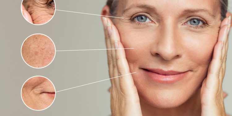 Facelift Without Surgery? Here Are The Treatments Experts Love