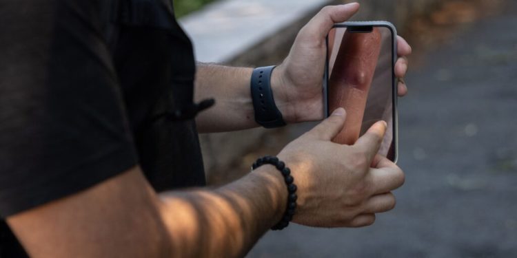 A health equity expert on making monkeypox messaging more inclusive