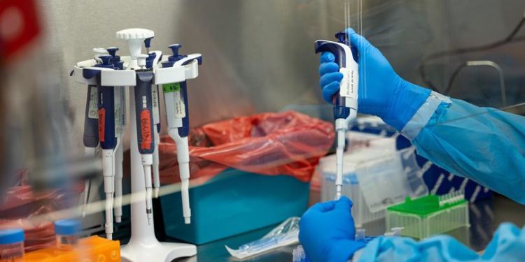 Here's Why You Won't Be Testing For Monkeypox At Home Anytime Soon