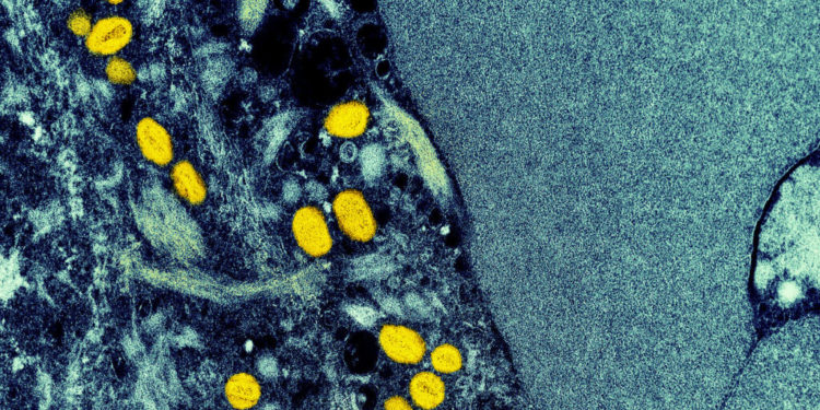How monkeypox spreads — what scientists know, and don't know