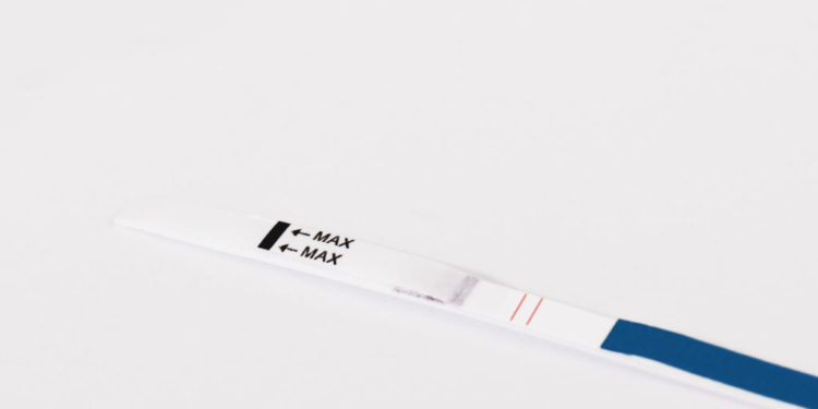 Once routine, pre-surgical pregnancy testing now is anything but