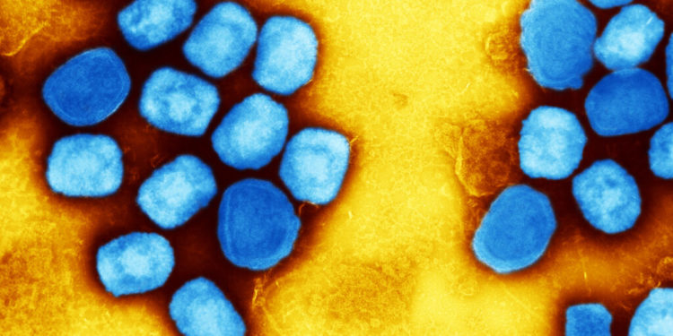 The campaign to rename monkeypox gets complicated