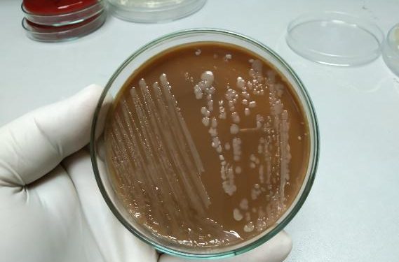 U.K. Hospital Trialling Cleaning Solution That’s ‘Better Than Bleach’