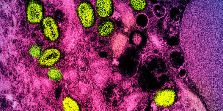 WHO renames lineages of monkeypox, moving away from geographic links