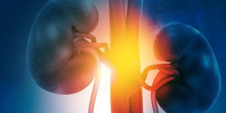 When removing a big kidney stone, get the little ones, too