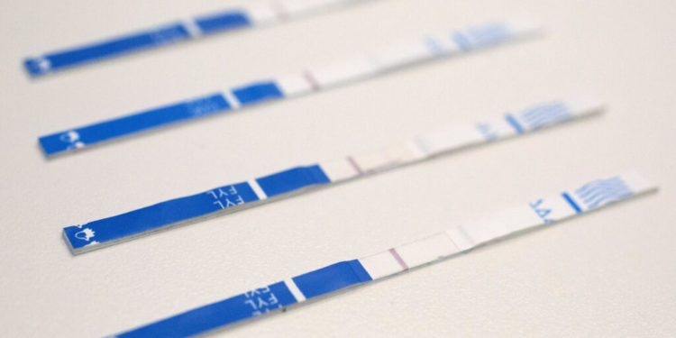 Fentanyl test strips could help save lives. In many states, they’re still illegal