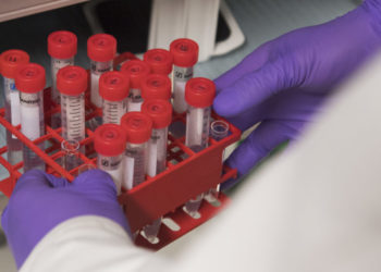 Lupus patients go into remission borrowing CAR-T cancer therapy